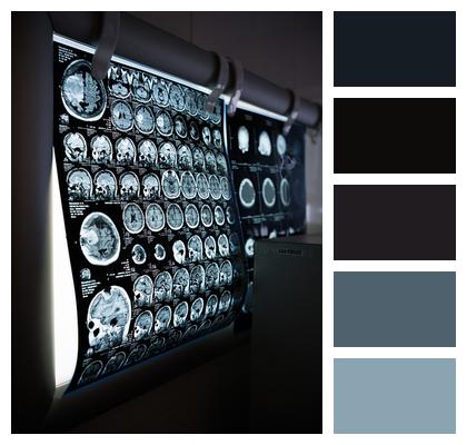 Head Magnetic Resonance Imaging Health Ct Scan Image